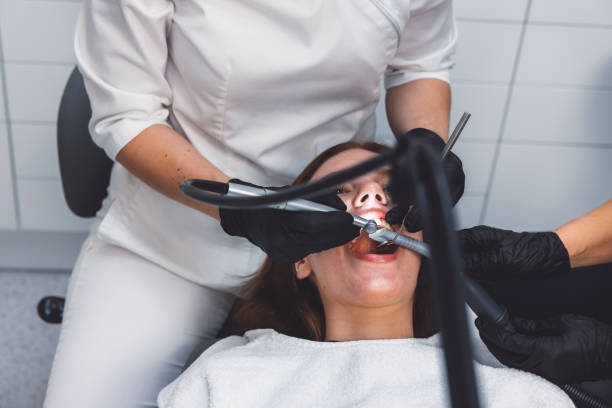 Best Emergency Wisdom Tooth Extraction in Alderton, WA